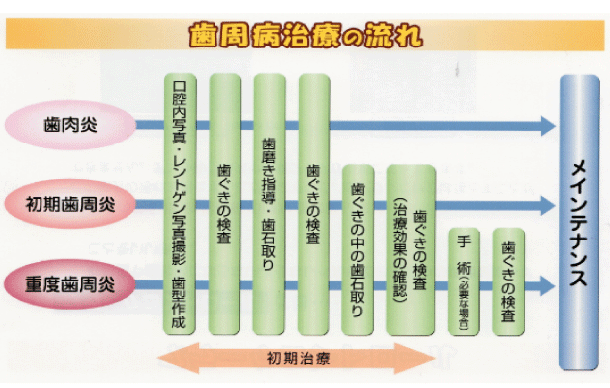 歯周病治療の流れ