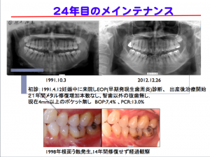 スクリーンショット 2015-02-01 10.11.44